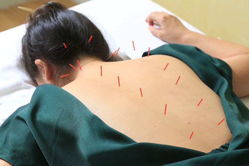 trị liệu theo phương pháp Đông Y Nhật Bản